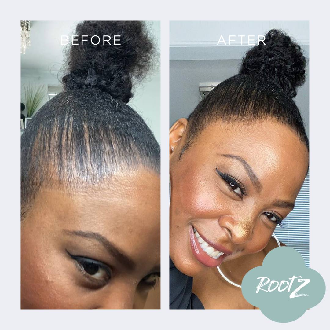 Black RootZ Before and After