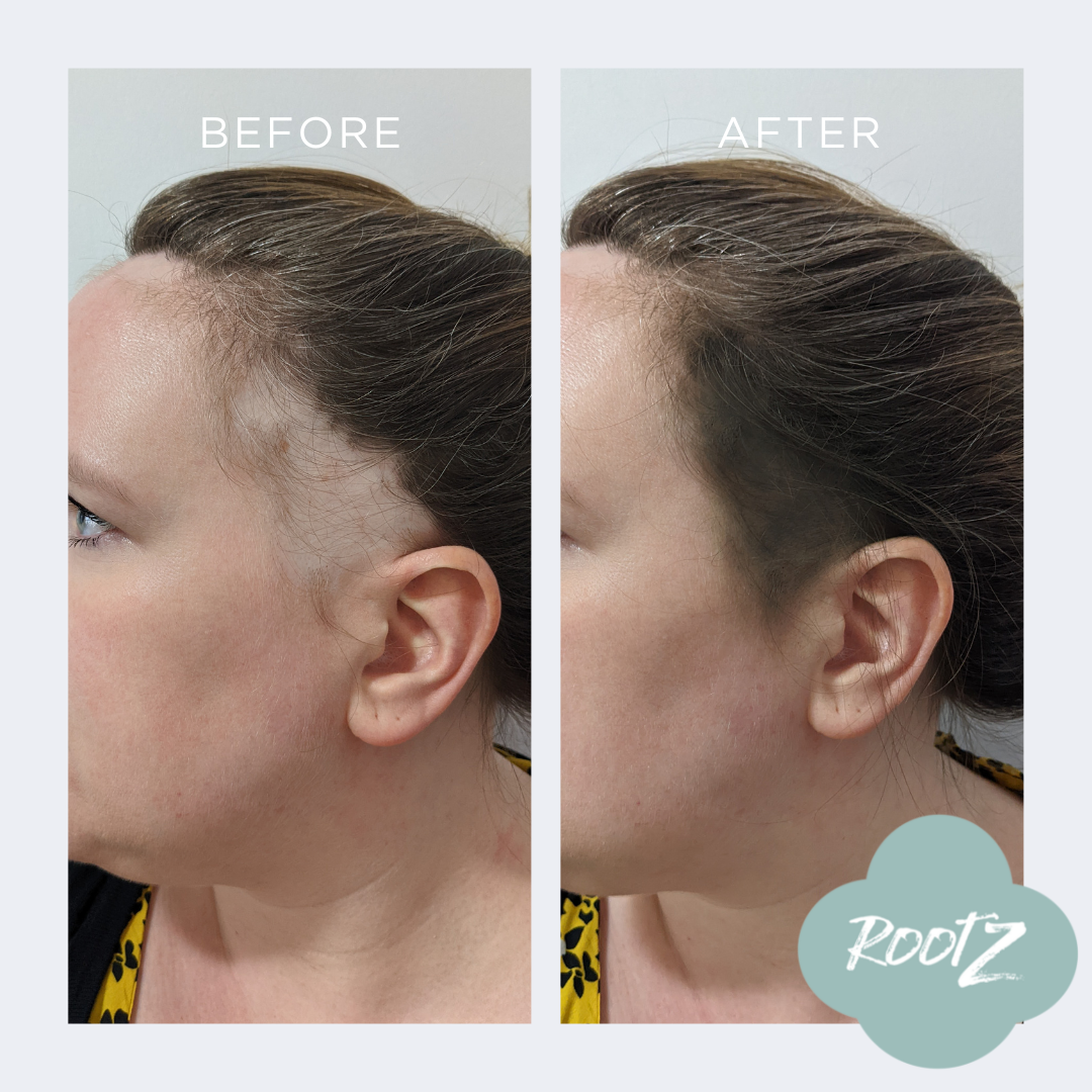 RootZ concealer before and after #colour_medium-brown