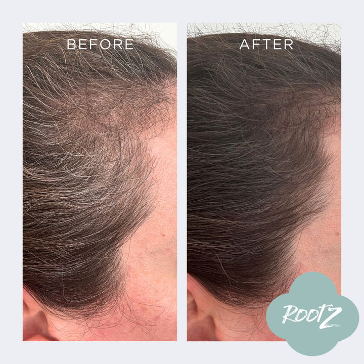 RootZ concealer before and after #colour_deep-dark-brown