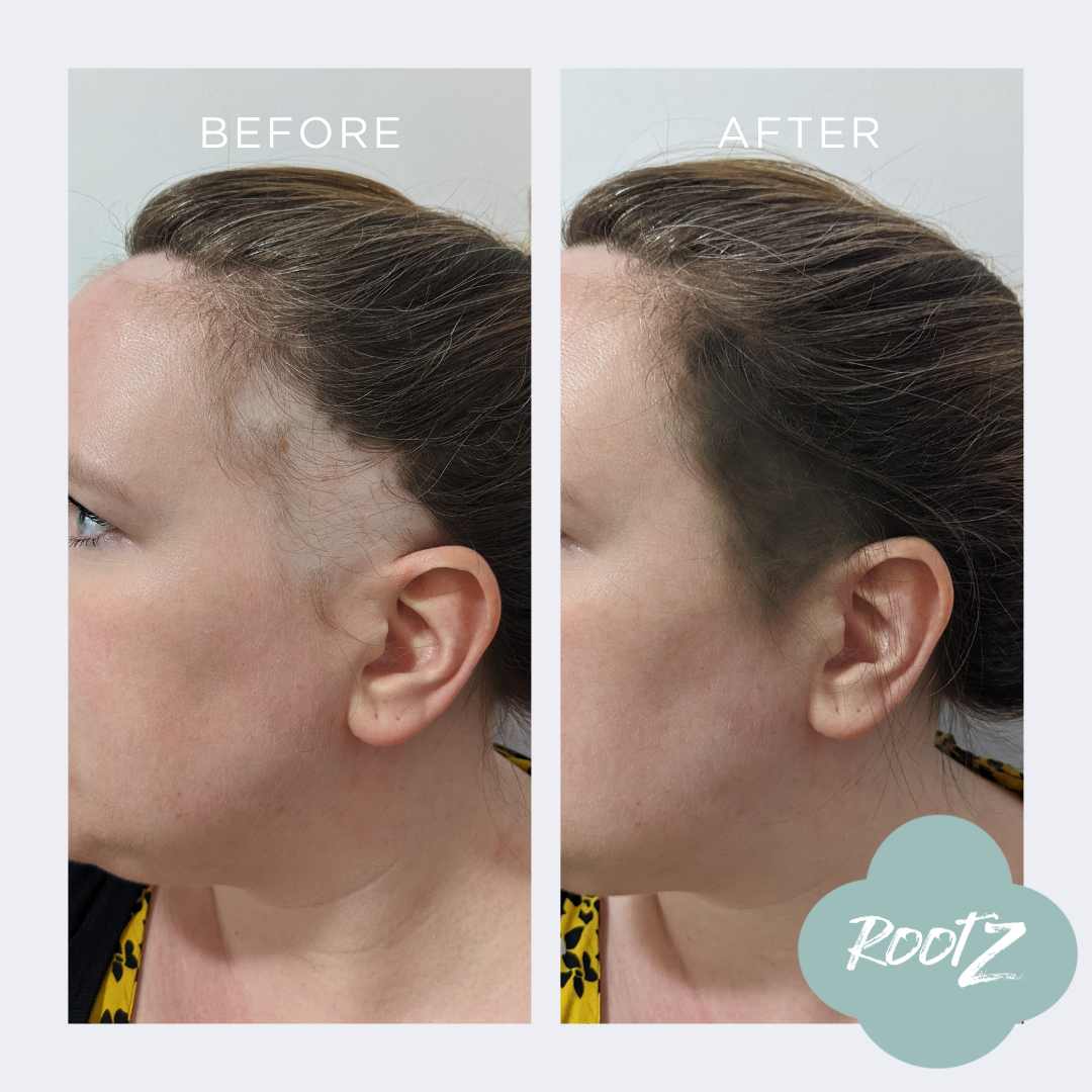 RootZ before and After #colour_medium-brown