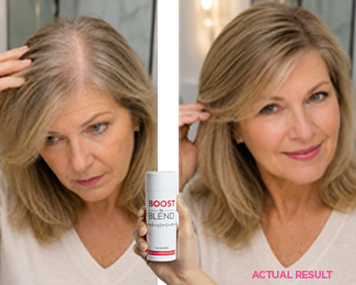 Woman with hair loss before and after Boost N Blend